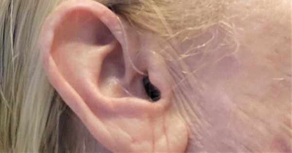 Hearing-loss.news - Mixed Hearing Loss
