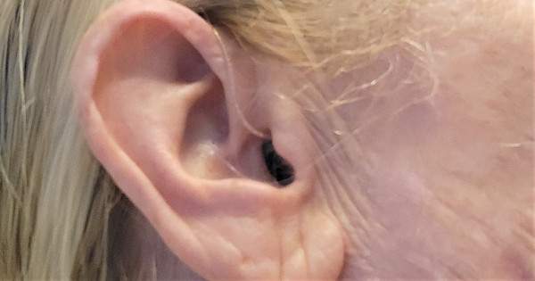 Understanding Sensorineural Hearing Loss: A Comprehensive Guide for Parents